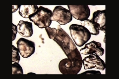 Aufnahme der Sandlückenfauna der Doggerbank unter dem Mikroskop, hier eine Schnecke zwischen Sandkörnern, Foto: BfN
